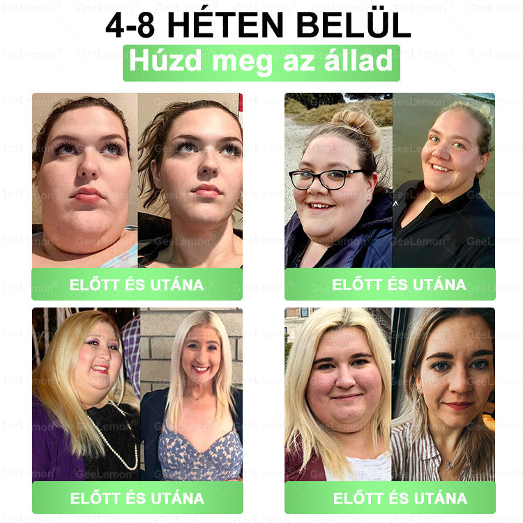 Ajánlott a Semmelweis Kórház által · 👩‍⚕️BENU hivatalos üzlet| 🎄✅ 𝐆𝐞𝑒𝐿𝑒𝐦𝐨𝐧® Glumasetide 8 az 1-ben Karcsú és Egészséges Nano Mikrotűs Tapasz 🇭🇺